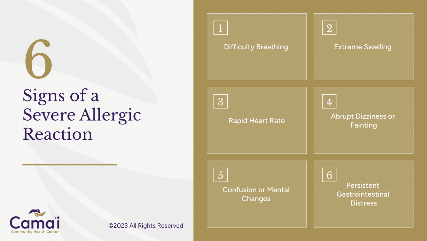 6 signs of a severe allergic reaction